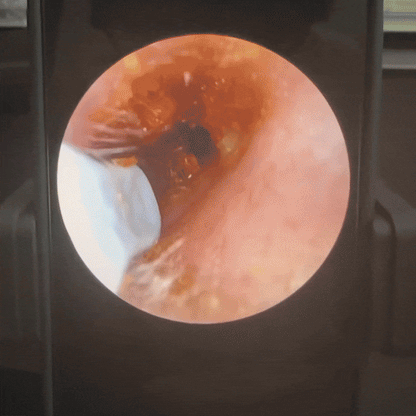 Previlya lumi-Cure  : L'hygiène auriculaire haute précision.